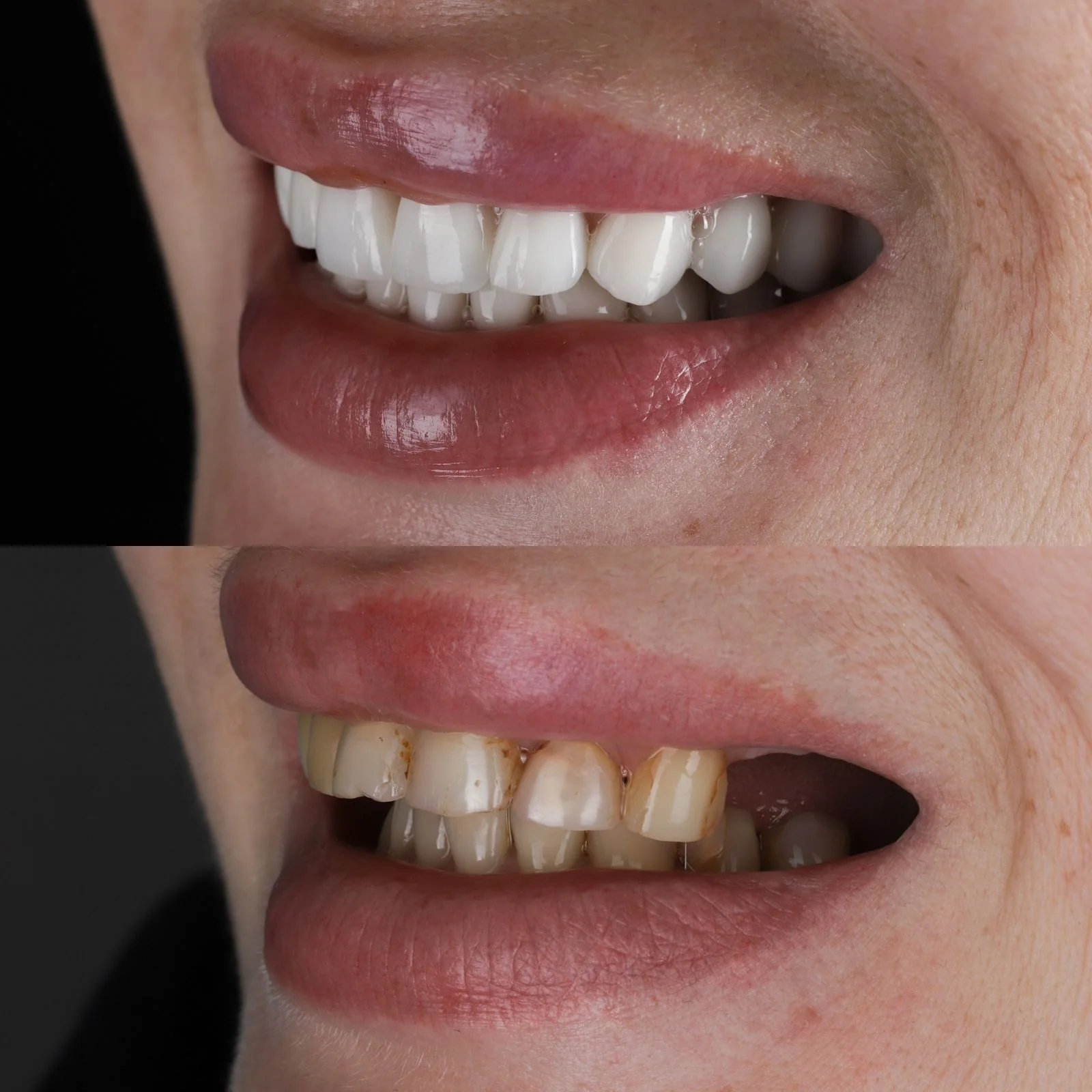 Dental before and after 1