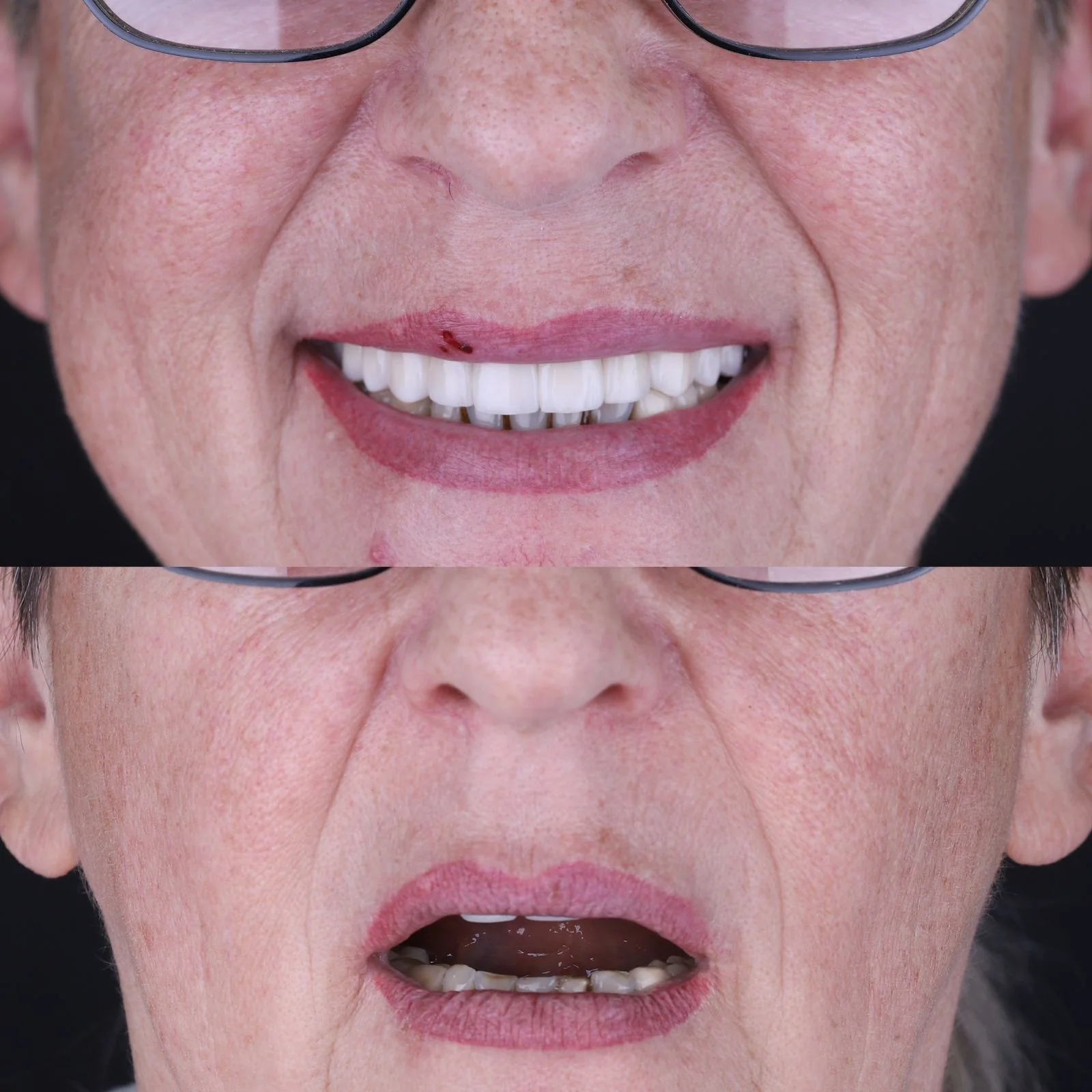 Dental before and after 2