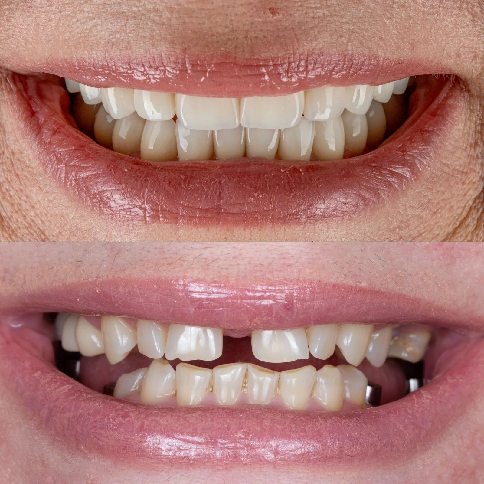 Dental before and after 3