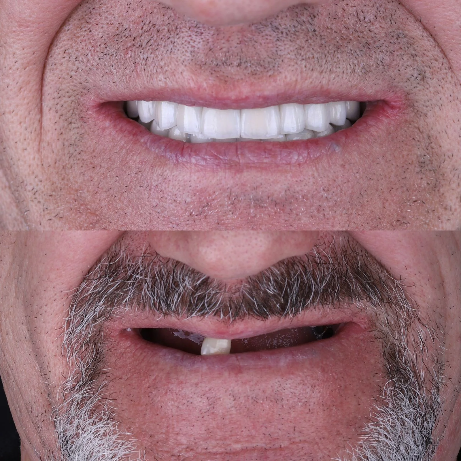 Dental before and after 5