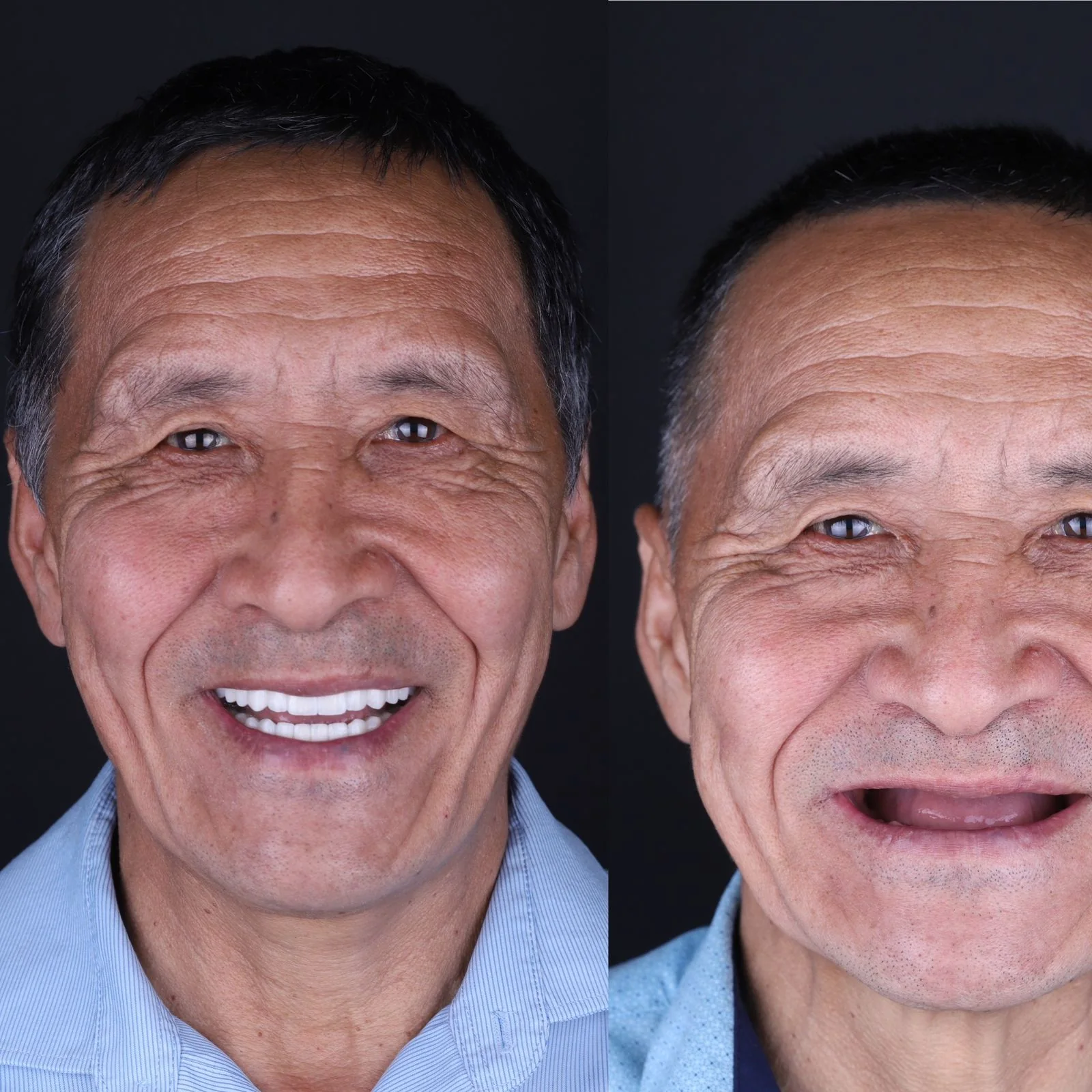 Dental before and after 6