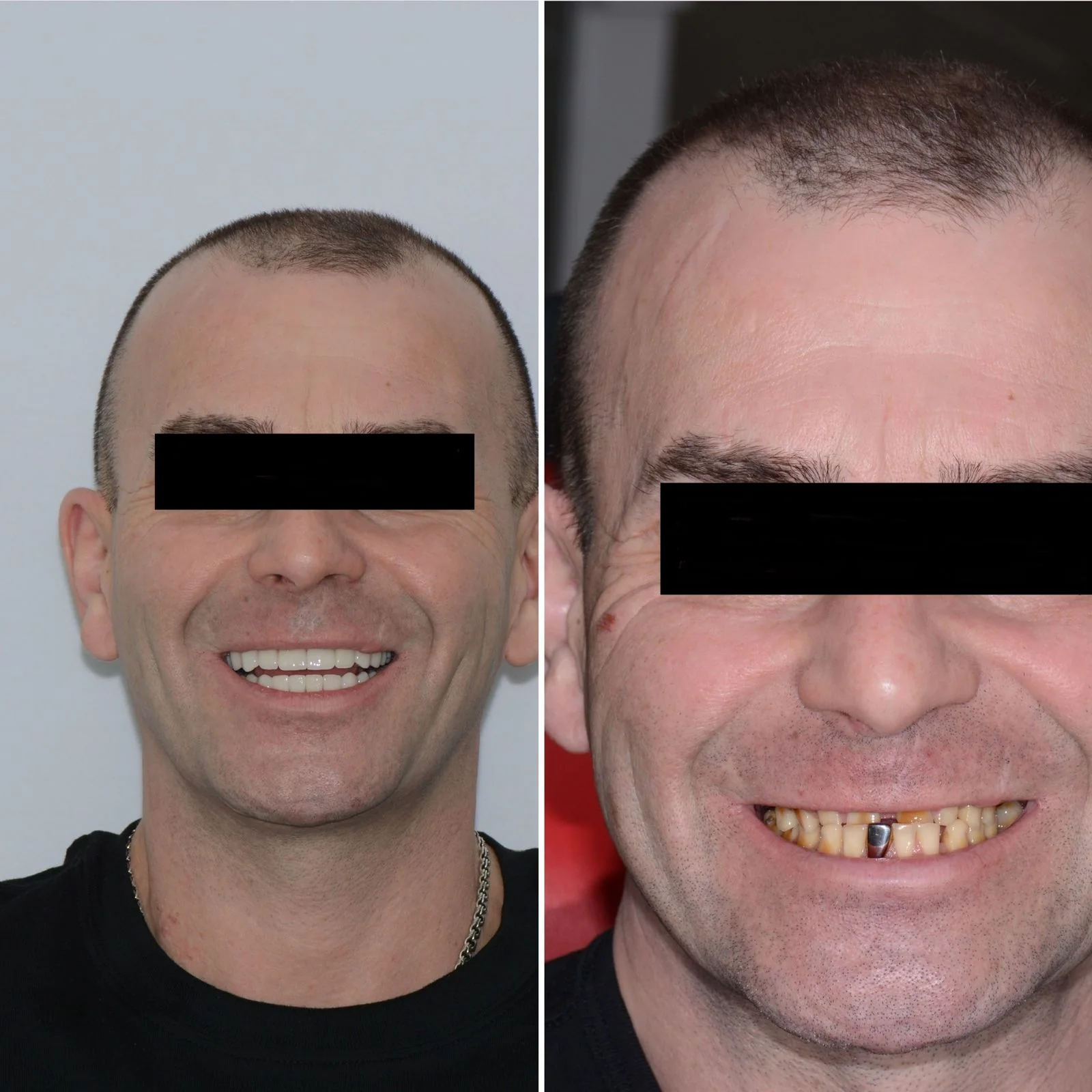 Dental before and after 7