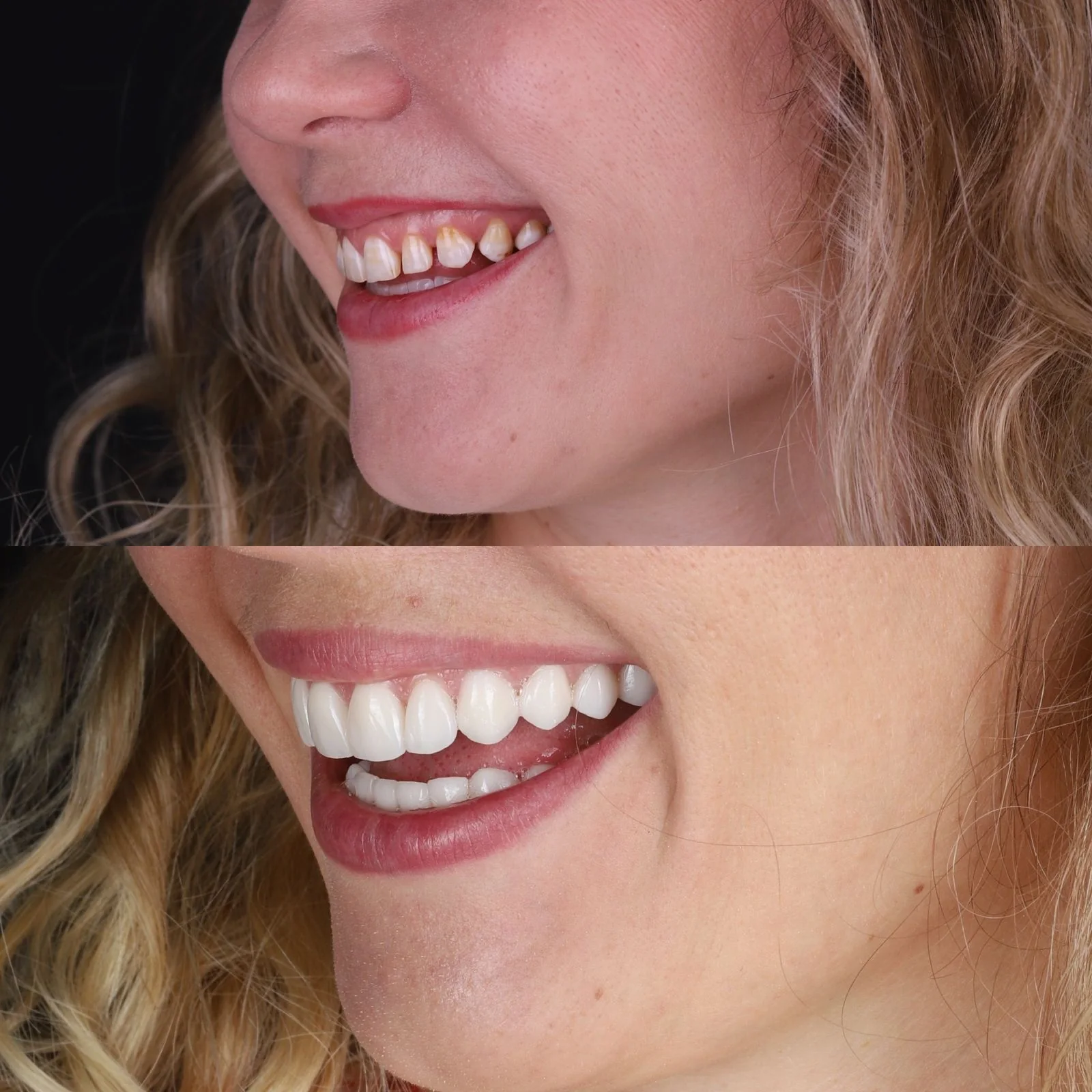 Dental before and after 8
