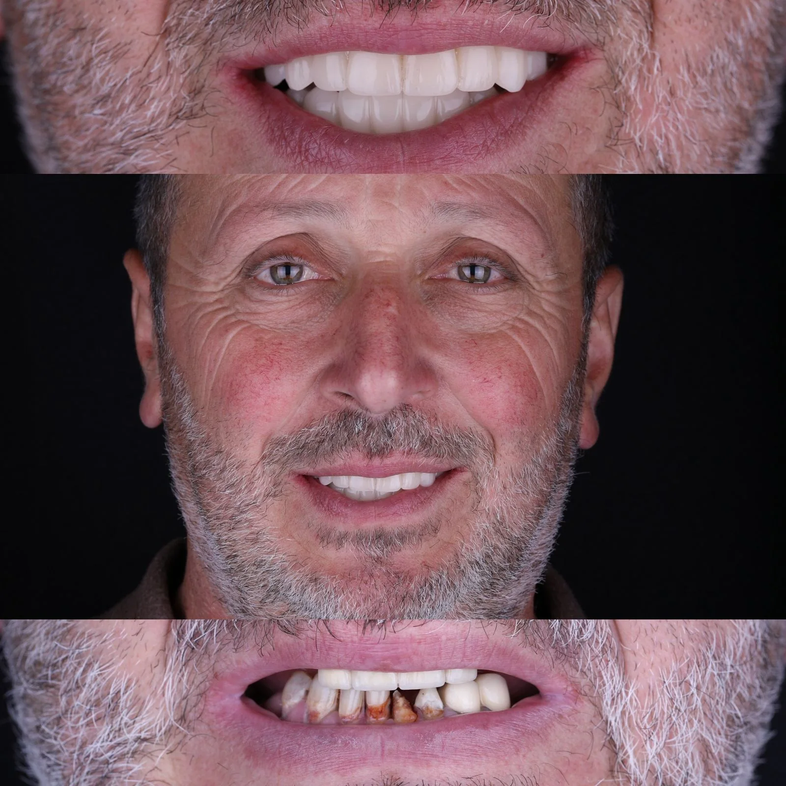 Dental before and after 10