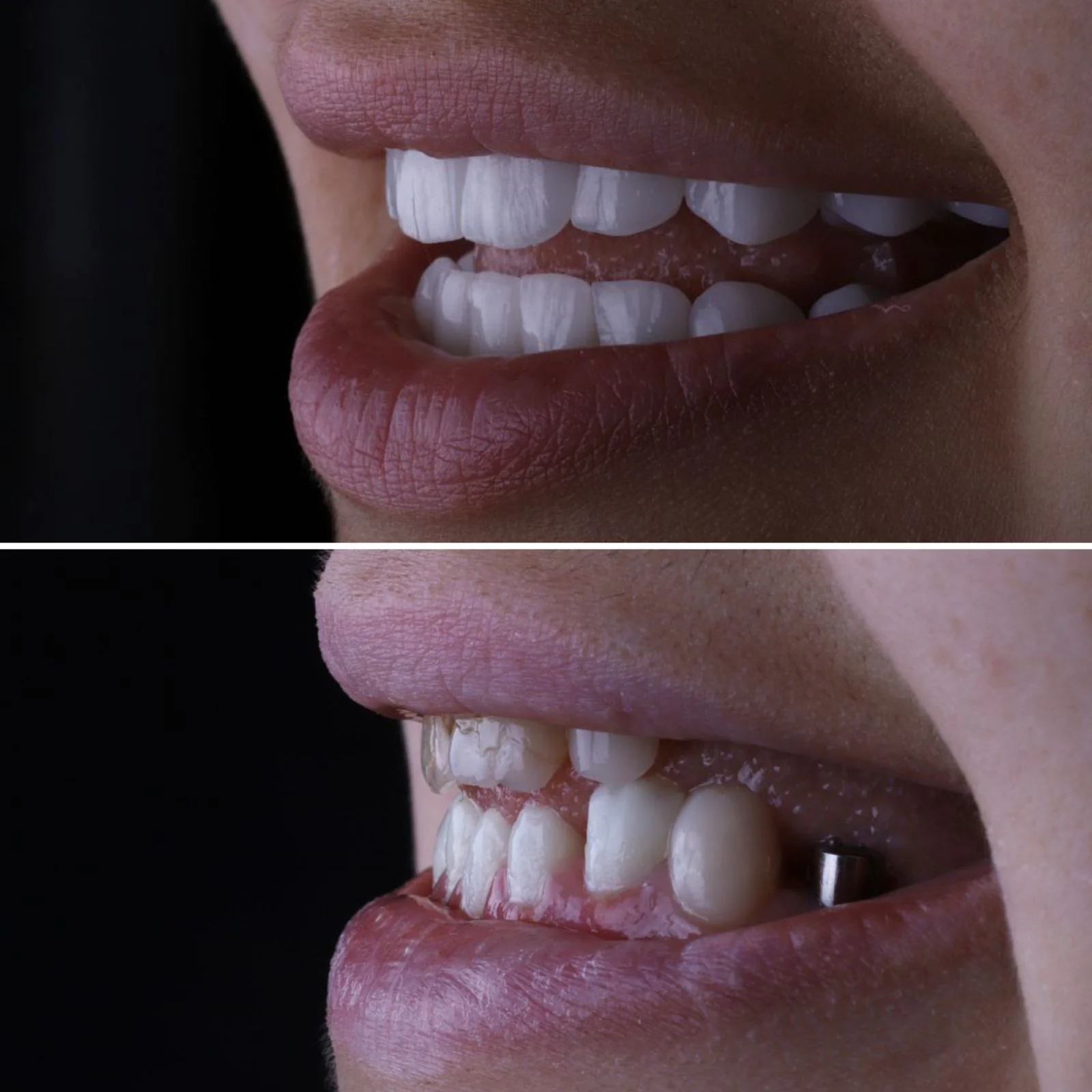 Dental before and after 11