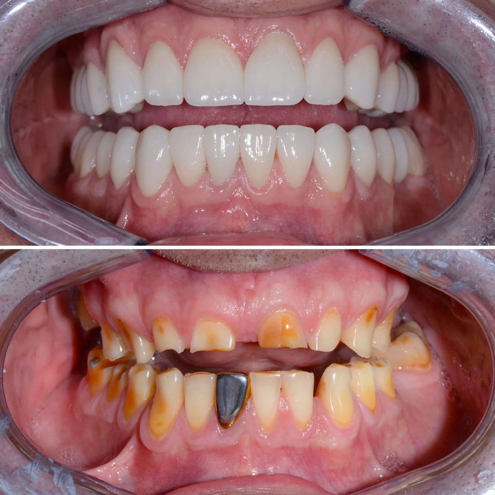 Dental before and after 12