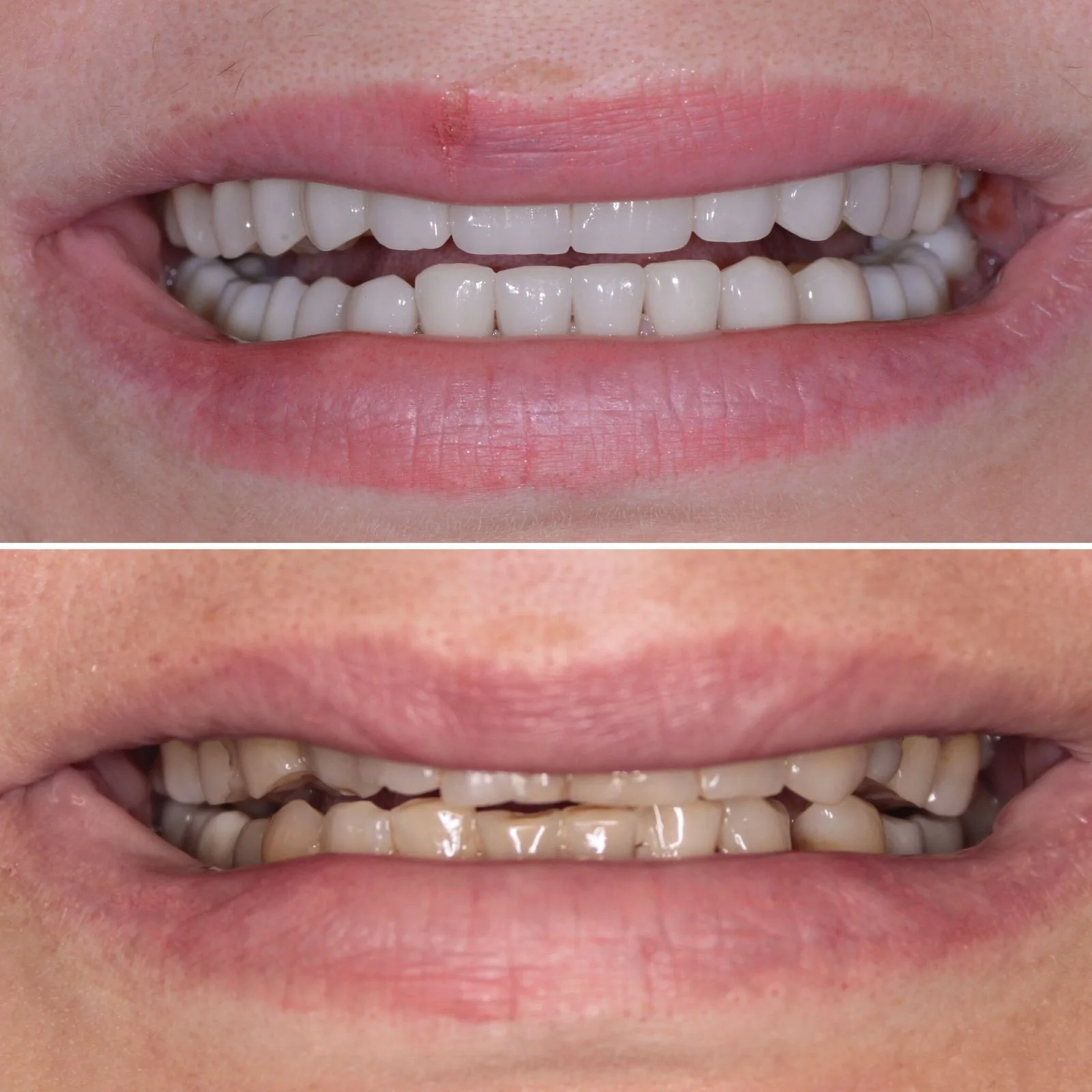 Dental before and after 13