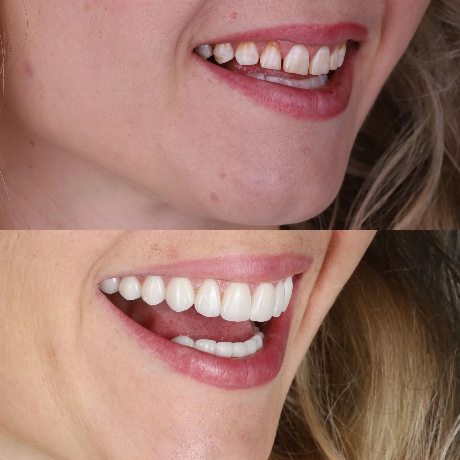 Dental before and after 15