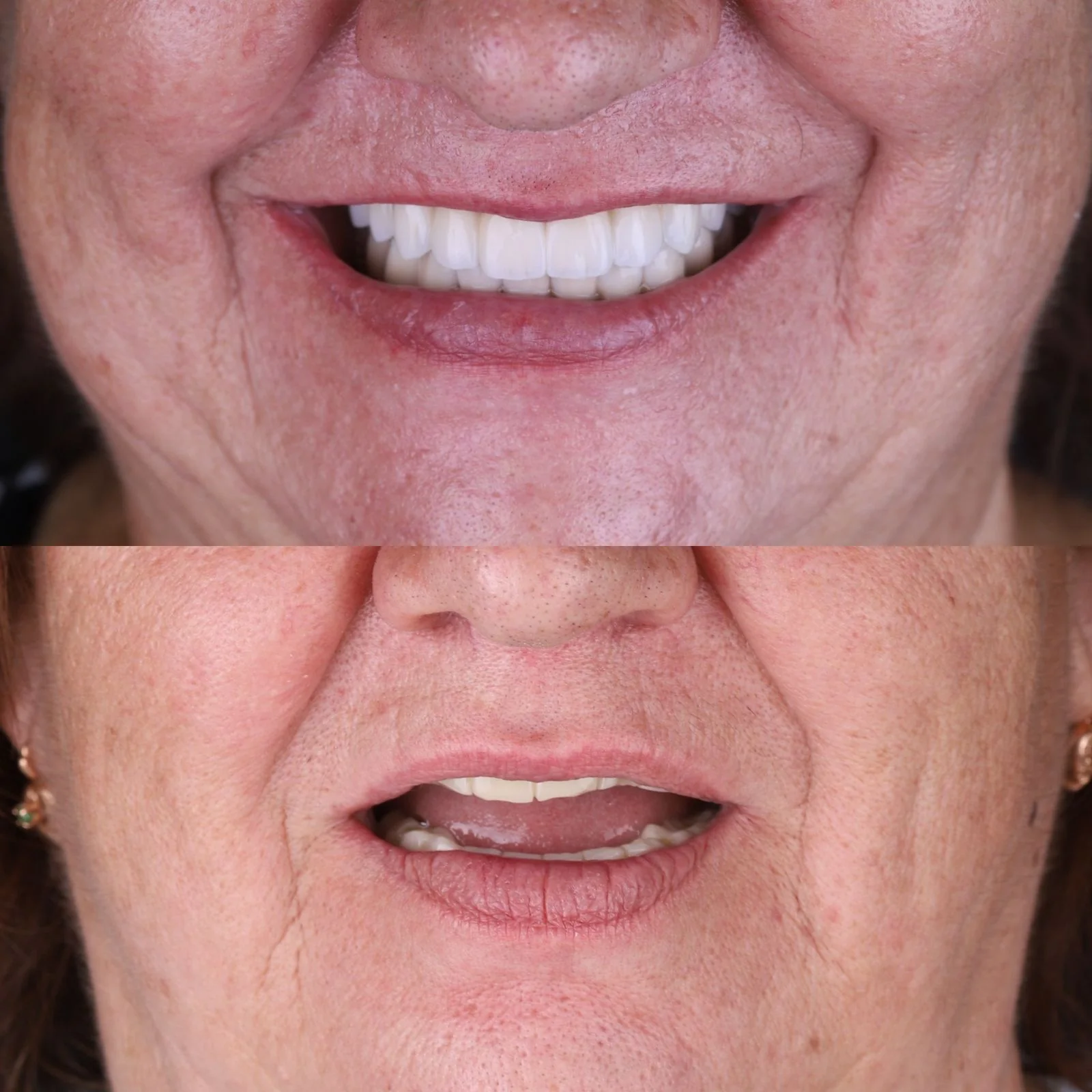 Dental before and after 16