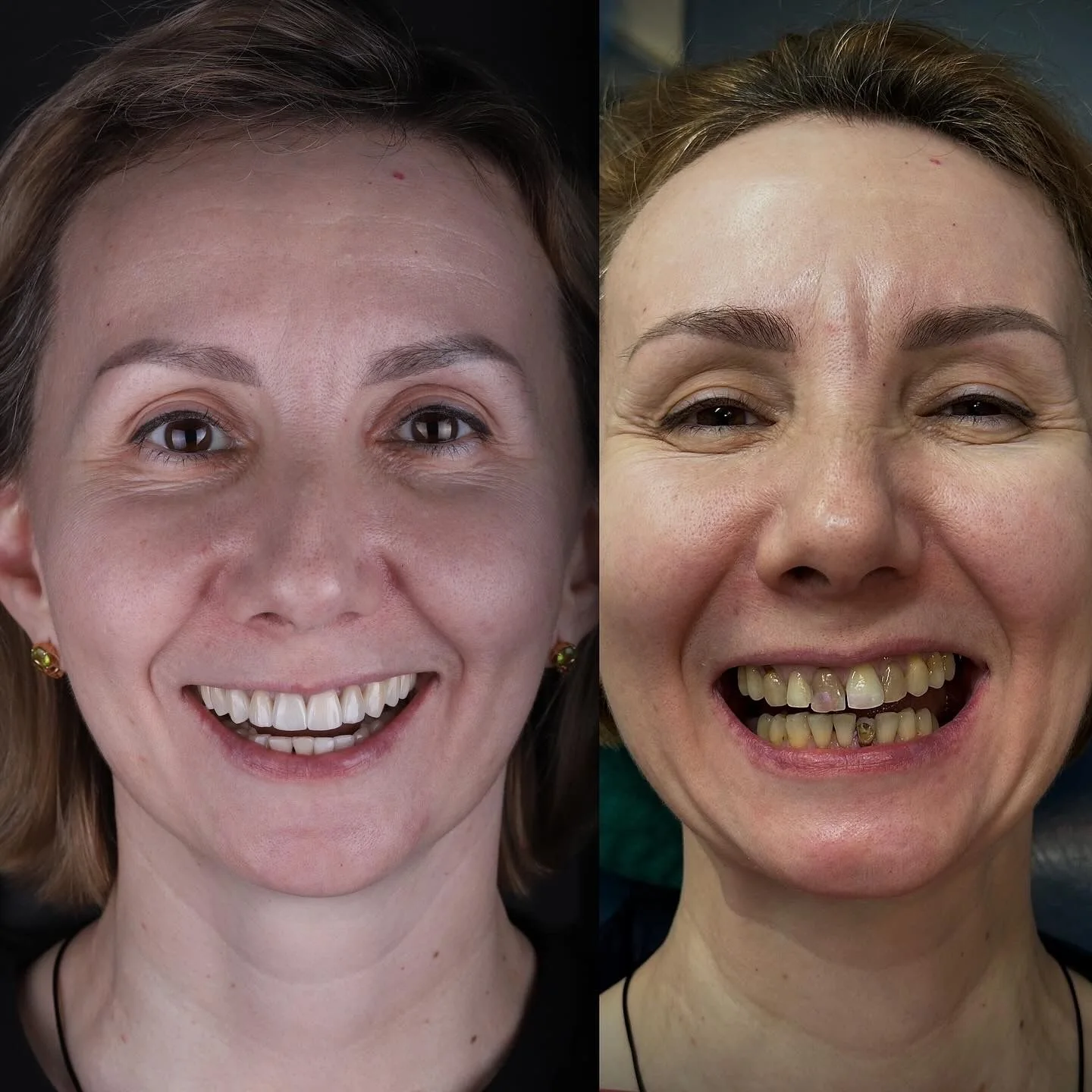 Dental before and after 17