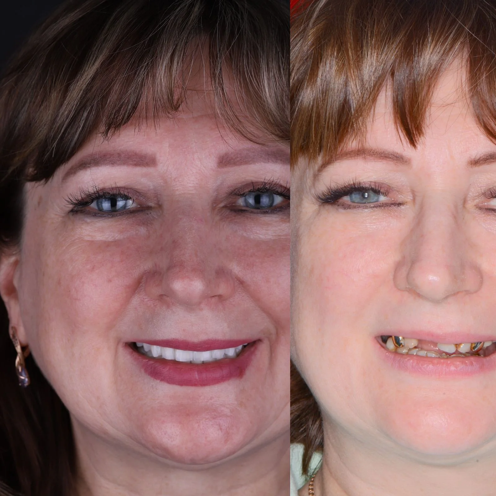Dental before and after 18