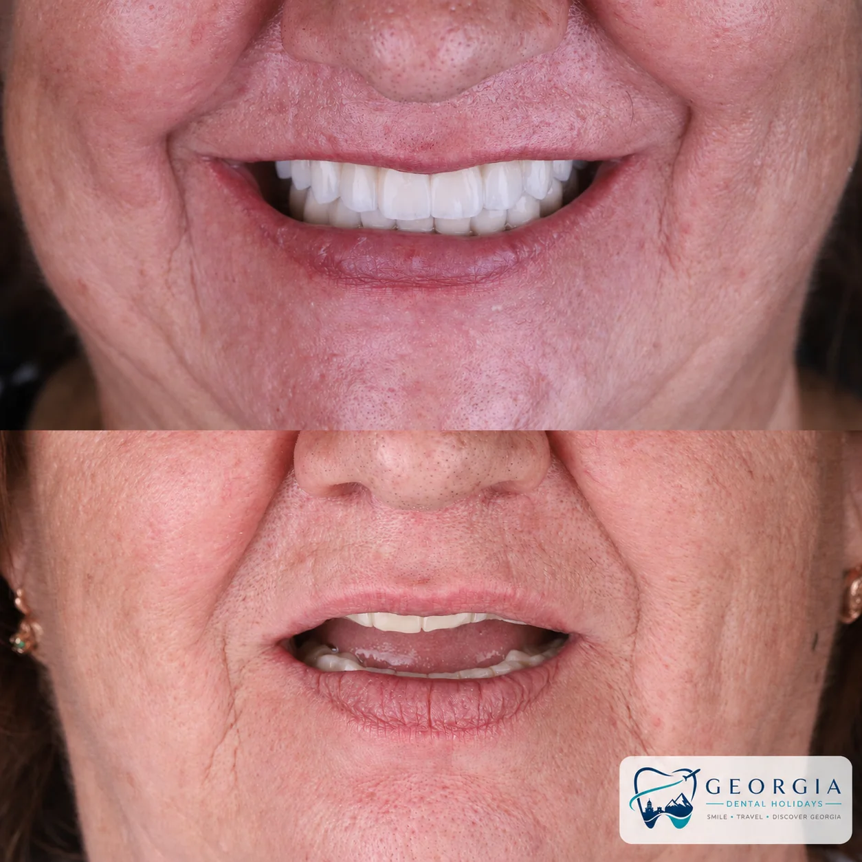Dental before and after 19