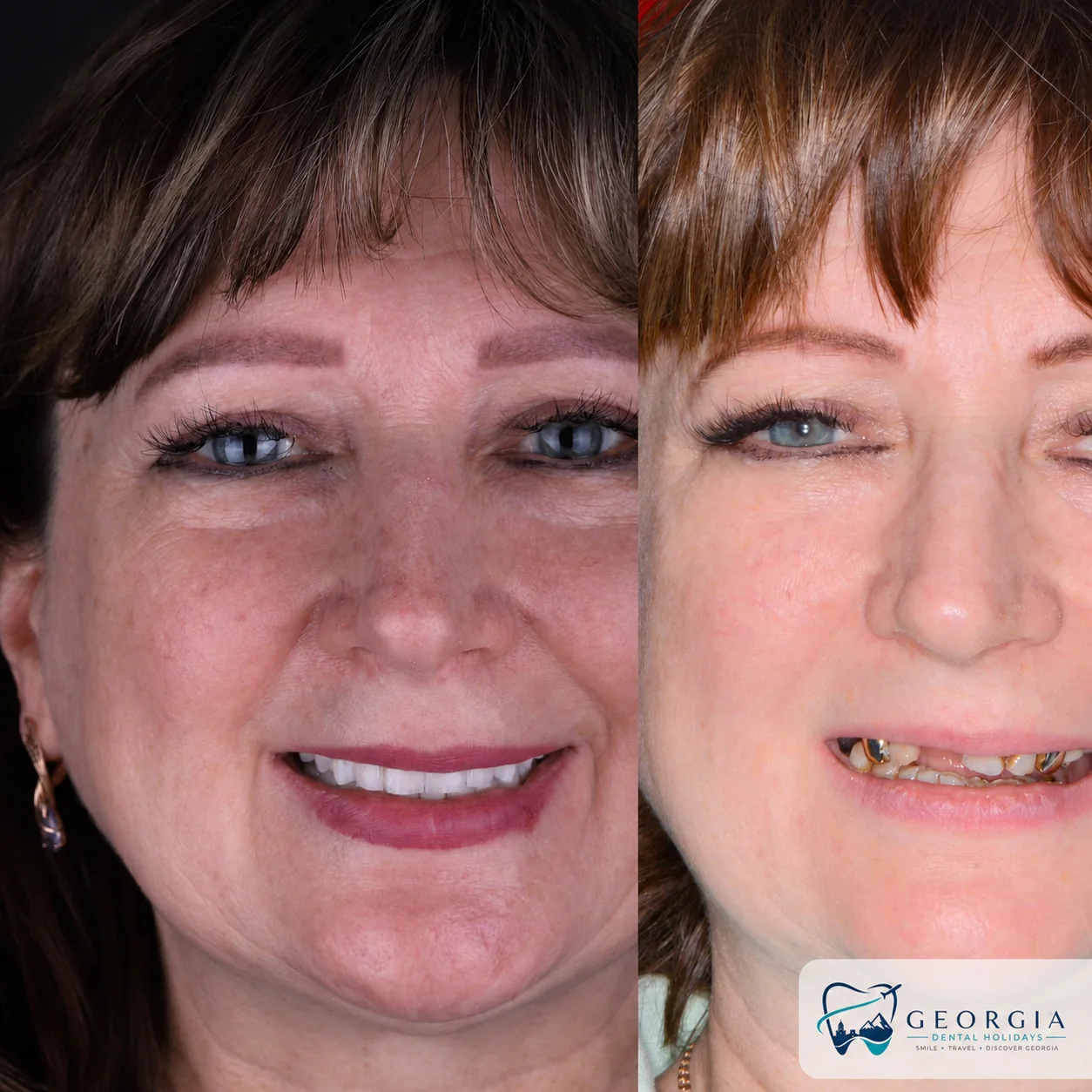 Dental before and after 20