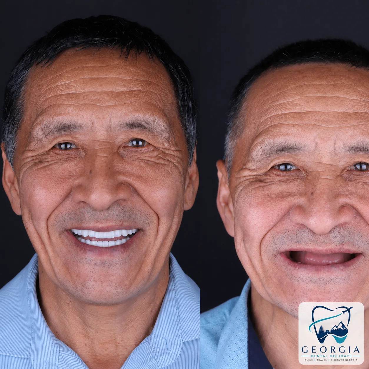 Dental before and after 21