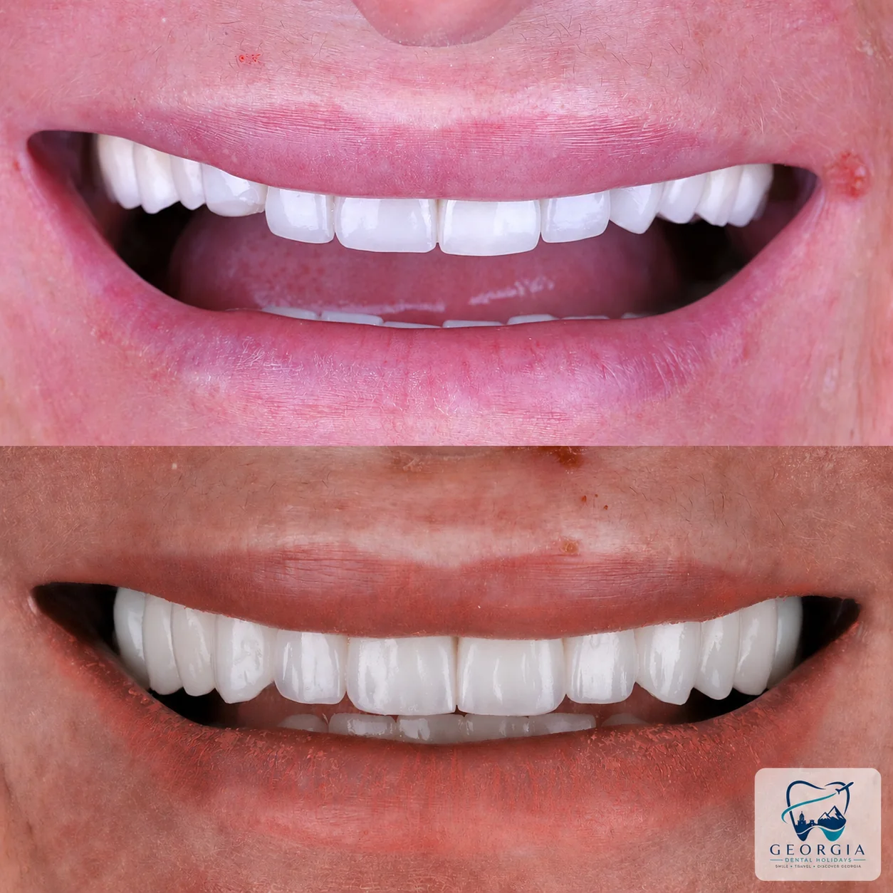 Dental before and after 22