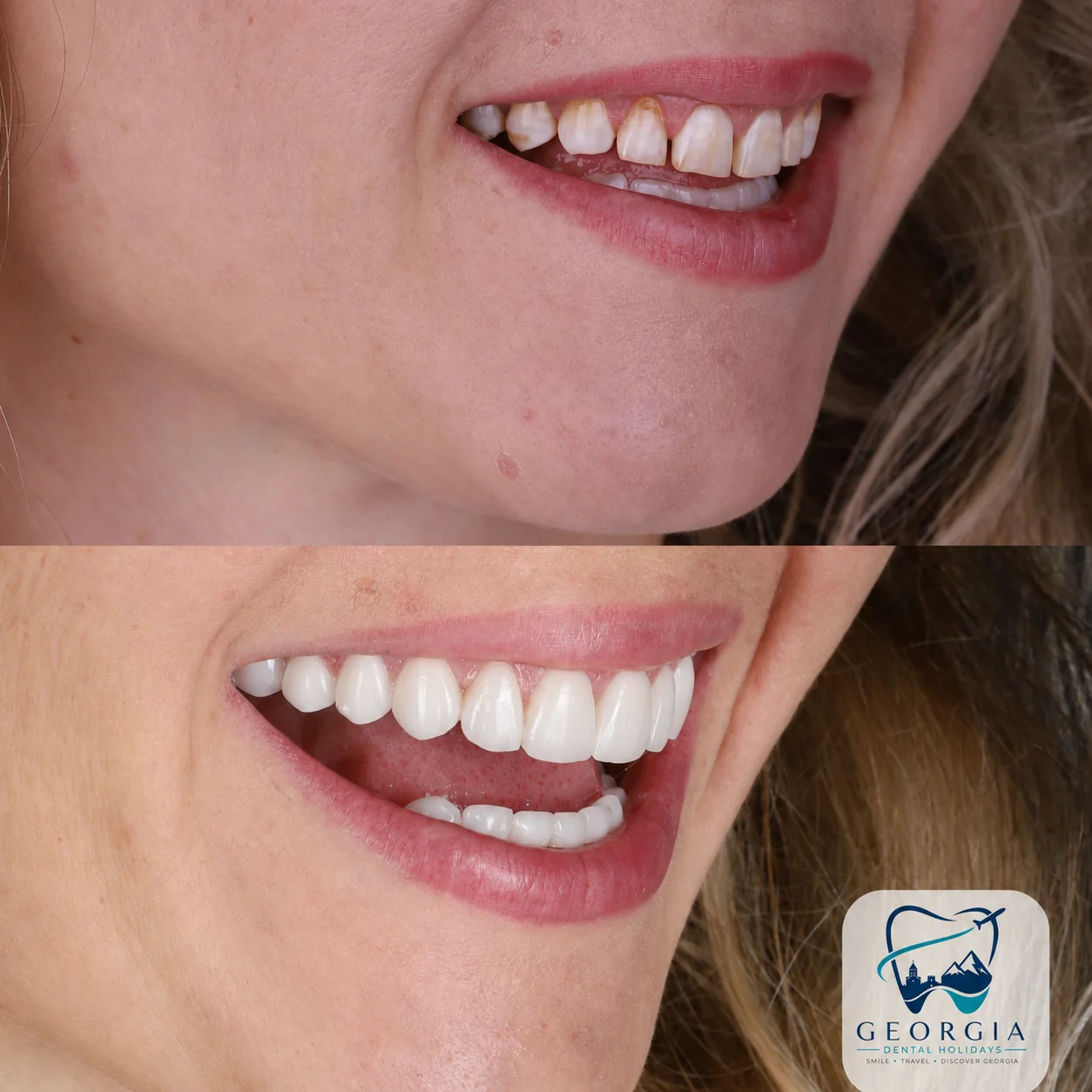 Dental before and after 23