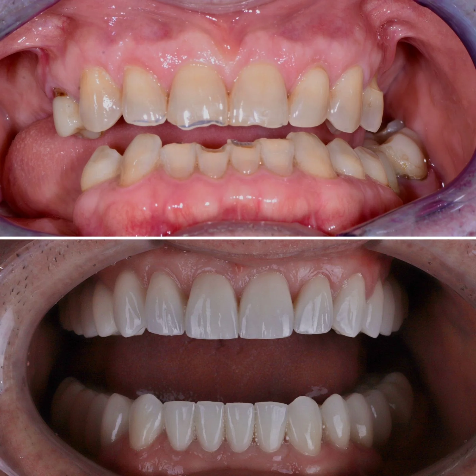 Dental before and after 24