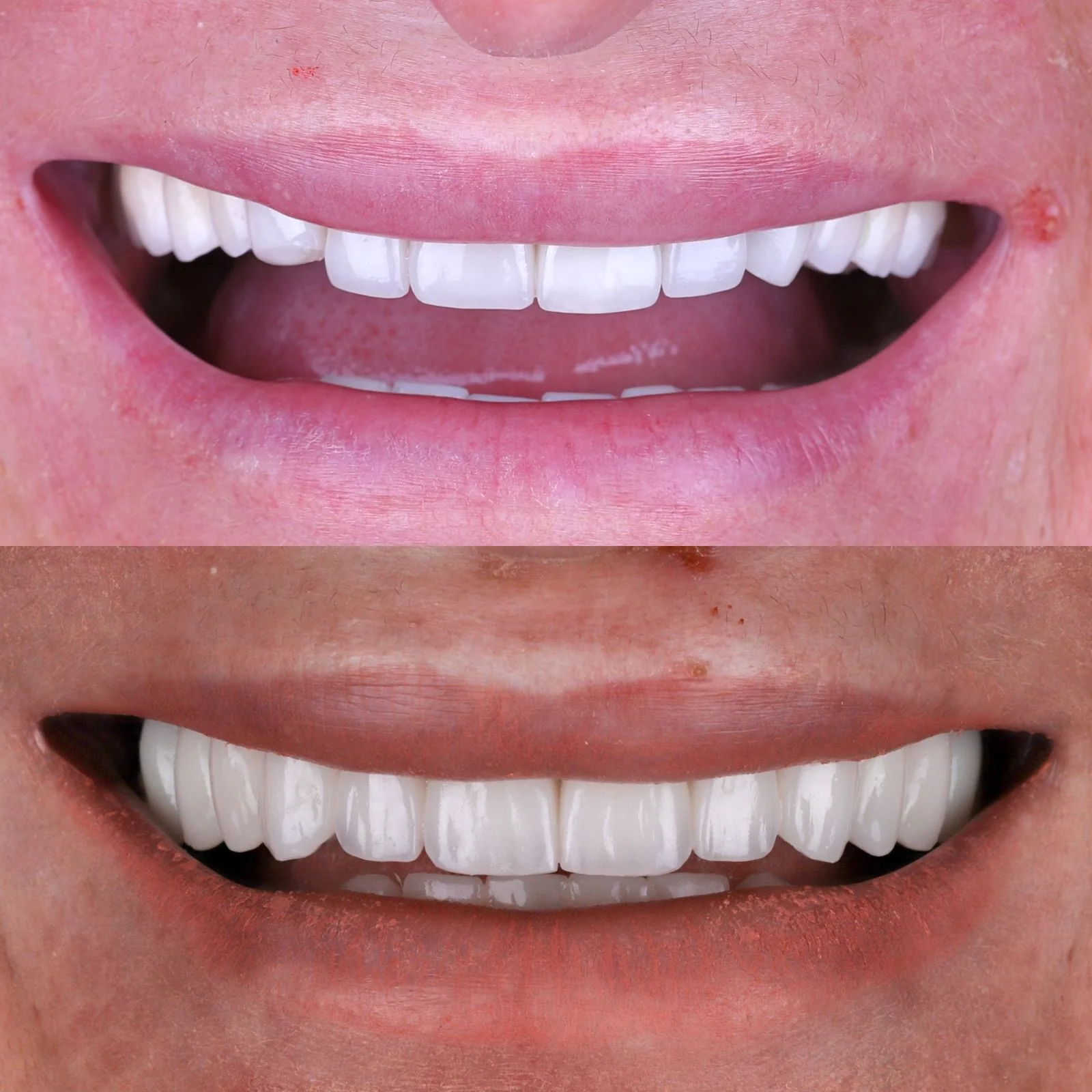 Dental before and after 25
