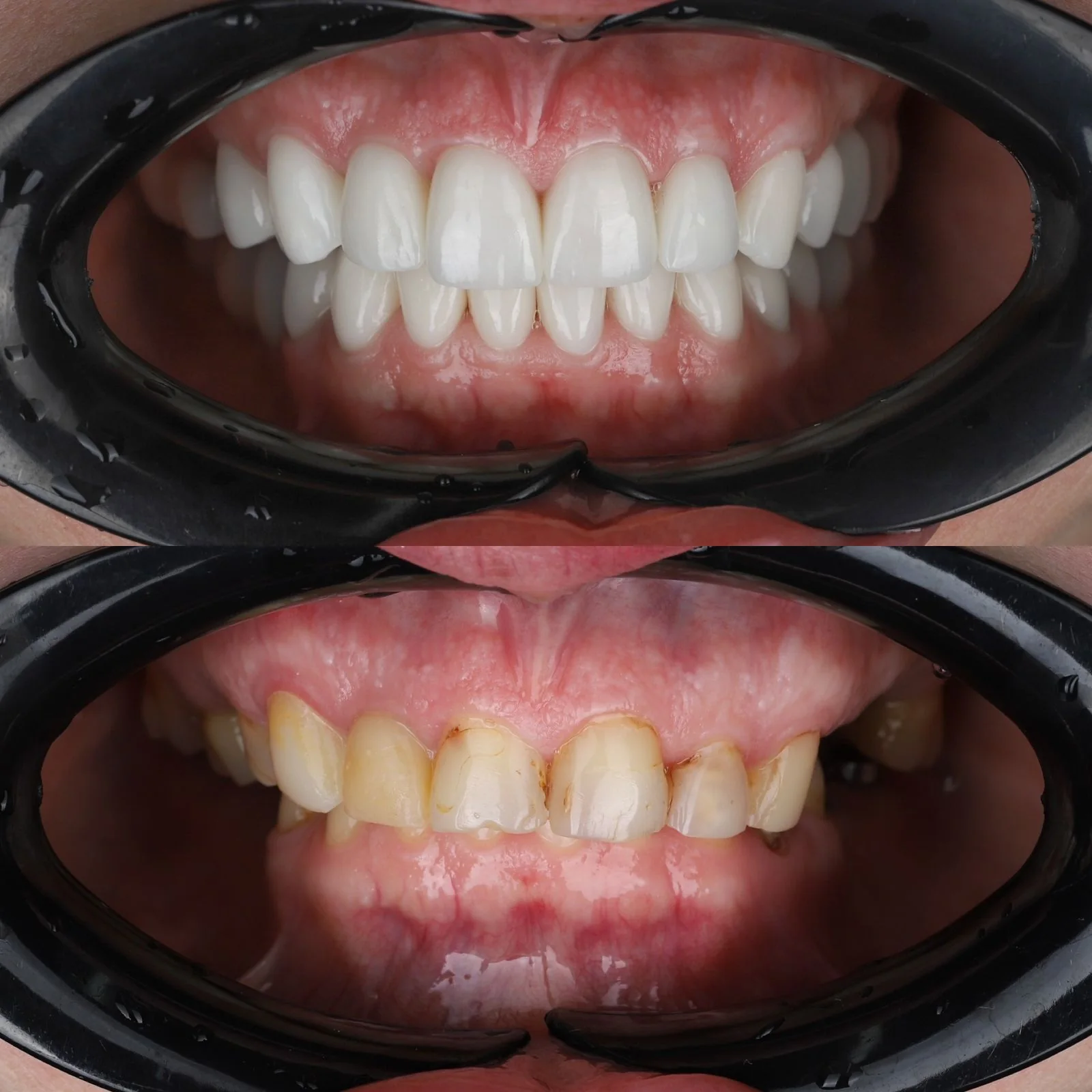 Dental before and after 27