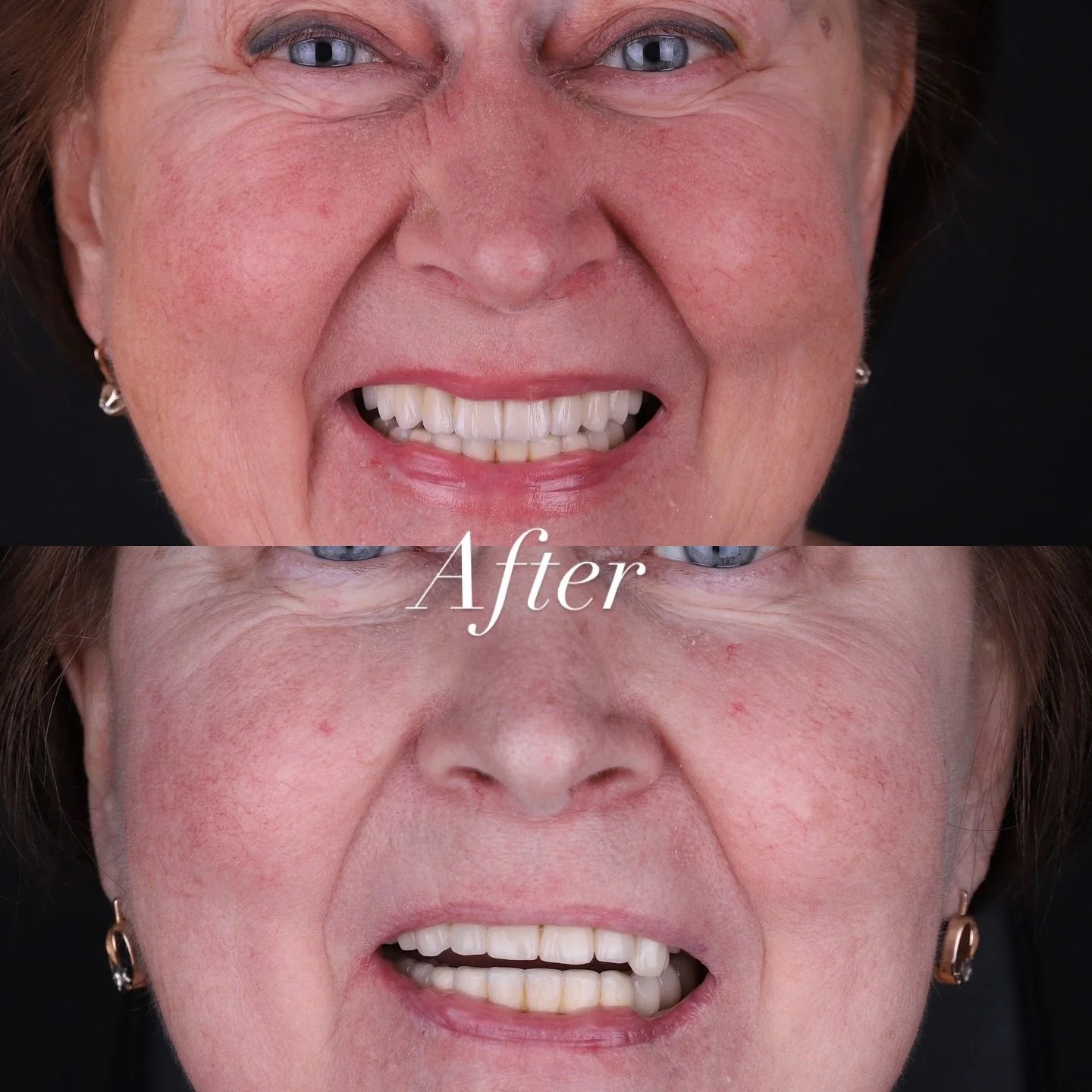 Dental before and after 28
