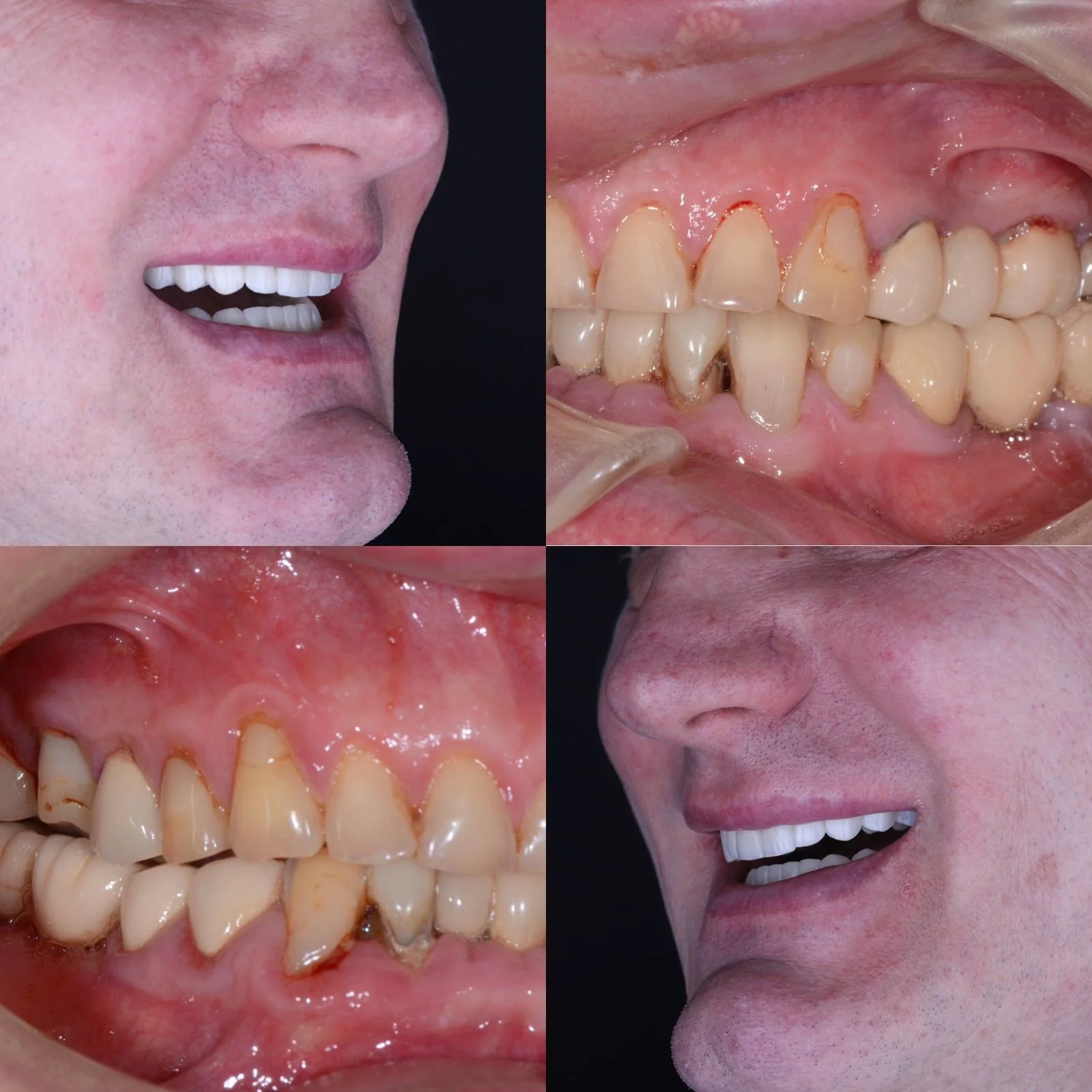 Dental before and after 29