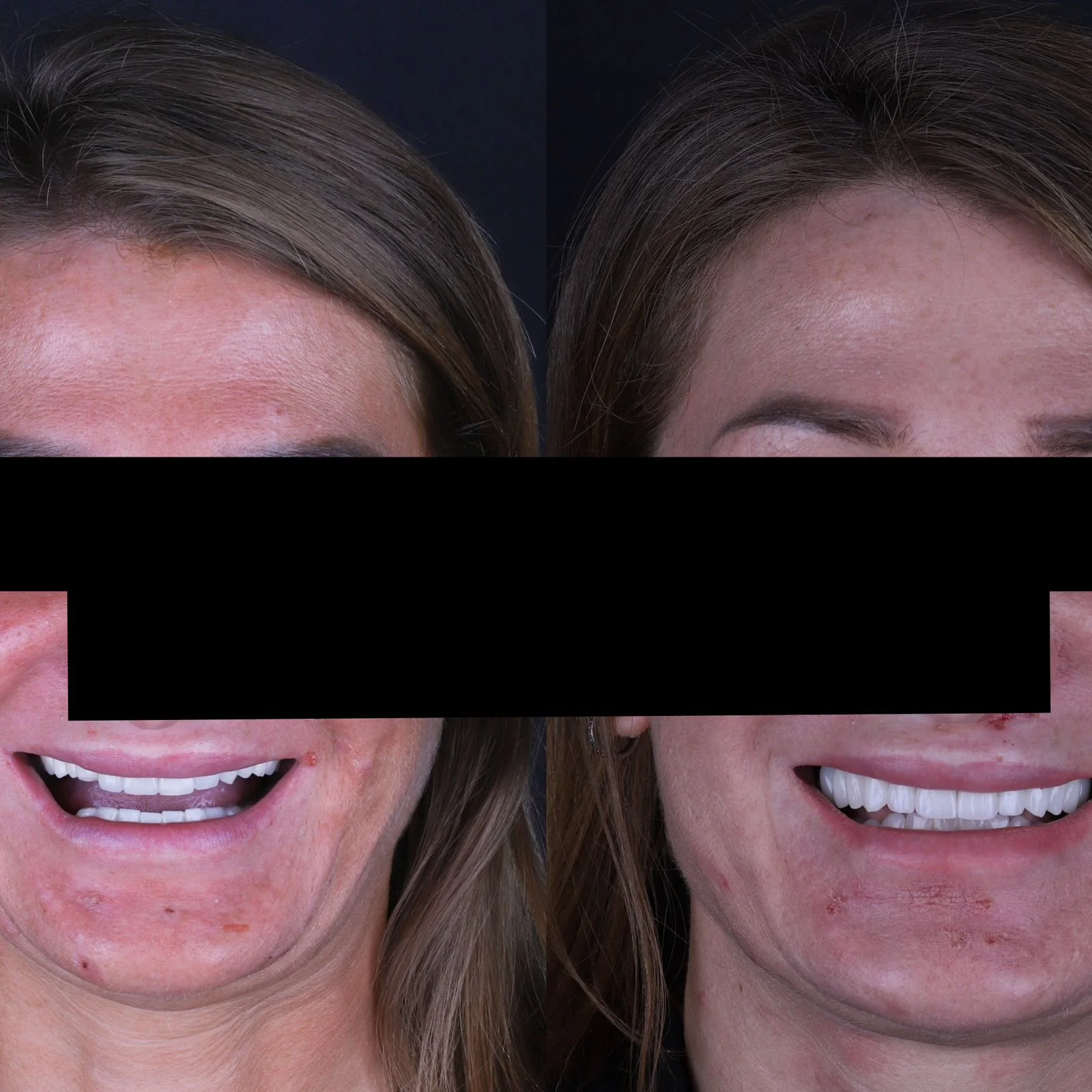 Dental before and after 32