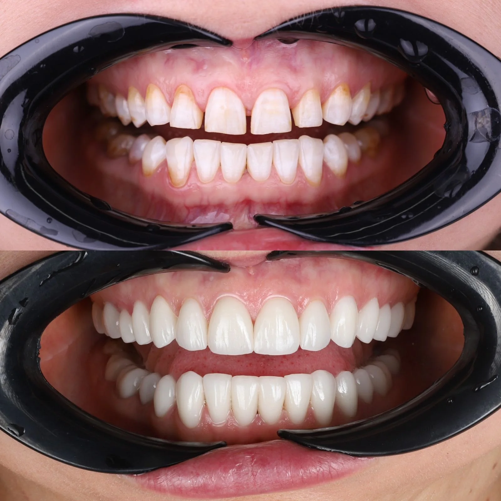 Dental before and after 33