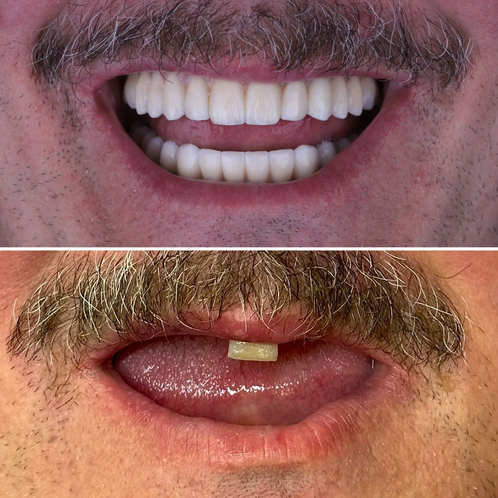 Dental before and after 34